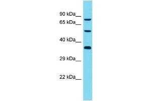 Host: Rabbit Target Name: DCAF8L2 Sample Type: Jurkat Whole Cell lysates Antibody Dilution: 1. (DCAF8L2 抗体  (C-Term))