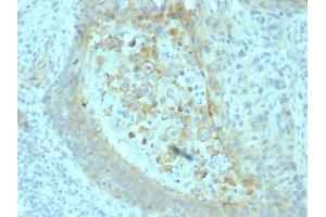 Immunohistochemistry (IHC) image for anti-5'-Nucleotidase, Ecto (CD73) (NT5E) antibody (ABIN6940229)
