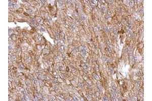IHC-P Image Immunohistochemical analysis of paraffin-embedded U87 xenograft, using Annexin III, antibody at 1:500 dilution. (Annexin A3 抗体)