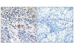 Immunohistochemistry (IHC) image for anti-Zinc Finger and BTB Domain Containing 40 (ZBTB40) (C-Term) antibody (ABIN1852400) (ZBTB40 抗体  (C-Term))