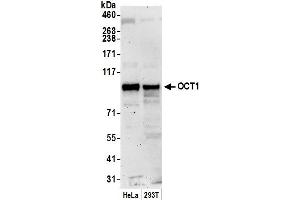 Western Blotting (WB) image for anti-POU Domain, Class 2, Transcription Factor 1 (POU2F1) (AA 693-743) antibody (ABIN7450522)