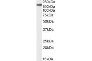 Western Blotting (WB) image for anti-CCR4-NOT Transcription Complex, Subunit 6-Like (CNOT6L) (Middle Region) antibody (ABIN2790464) (CNOT6L 抗体  (Middle Region))