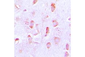Immunohistochemical analysis of BCL2 staining in human brain formalin fixed paraffin embedded tissue section. (Bcl-2 抗体  (Center))