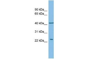 Western Blotting (WB) image for anti-V-Ral Simian Leukemia Viral Oncogene Homolog B (Ras Related, GTP Binding Protein) (Ralb) (Middle Region) antibody (ABIN2786742)
