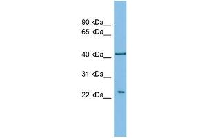 WB Suggested Anti-RALB Antibody Titration: 0. (RALB 抗体  (Middle Region))
