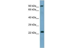 KRAS antibody used at 1 ug/ml to detect target protein. (K-RAS 抗体  (N-Term))