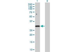 Western Blot analysis of SNRPA expression in transfected 293T cell line by SNRPA MaxPab polyclonal antibody. (SNRPA1 抗体  (AA 1-282))