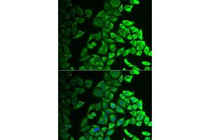 Immunofluorescence analysis of A549 cell using IL18BP antibody. (IL18BP 抗体)