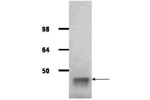 IgG purified antibody to rabbit muscle aldolase (100-1141, 200-1141 and 200-1341) was used at a 1:1000 dilution to detect human aldolase by western blot. (Aldolase 抗体  (HRP))