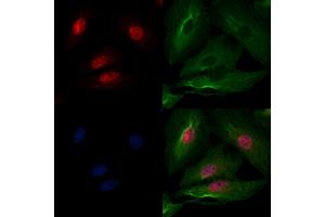 ABIN6259505 and ABIN6275797 staining  cells by IF/ICC. (CHFR 抗体  (Internal Region))