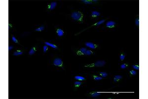 Immunofluorescence of purified MaxPab antibody to GOLM1 on HeLa cell. (GOLM1 抗体  (AA 1-401))
