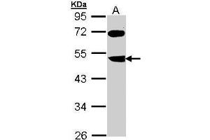 WB Image Sample (30 ug of whole cell lysate) A: Molt-4 , 10% SDS PAGE antibody diluted at 1:1000 (FBXL3 抗体)