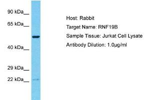 Host: Rabbit Target Name: RNF19B Sample Tissue: Human Jurkat Whole Cell Antibody Dilution: 1ug/ml (RNF19B 抗体  (C-Term))