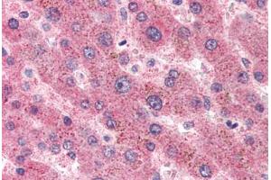 Human Liver (formalin-fixed, paraffin-embedded) stained with SAA1 antibody ABIN305908 at 5 ug/ml followed by biotinylated anti-mouse IgG secondary antibody ABIN481714, alkaline phosphatase-streptavidin and chromogen. (SAA1 抗体)