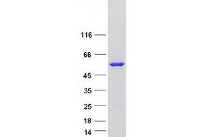 Western Blotting (WB) image for Flavin Containing Monooxygenase 3 (FMO3) (Transcript Variant 2) protein (Myc-DYKDDDDK Tag) (ABIN2721250)