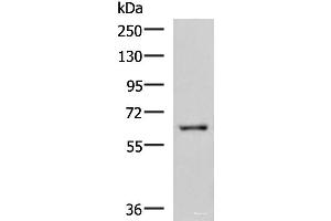 Western blot analysis of HepG2 cell lysate using LILRB5 Polyclonal Antibody at dilution of 1:600 (LILRB5 抗体)