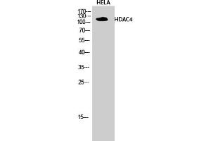 Western Blotting (WB) image for anti-Histone Deacetylase 4 (HDAC4) (Ser632) antibody (ABIN5956852) (HDAC4 抗体  (Ser632))