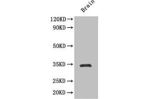 Western Blotting (WB) image for anti-SRY (Sex Determining Region Y)-Box 2 (SOX2) (AA 1-317) antibody (ABIN7172615)