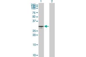 Western Blot analysis of CDK4 expression in transfected 293T cell line by CDK4 MaxPab polyclonal antibody. (CDK4 抗体  (AA 1-303))
