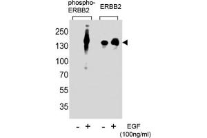 Western Blotting (WB) image for anti-Receptor tyrosine-protein kinase erbB-2 (ErbB2/Her2) (pTyr1248) antibody (ABIN2970949)