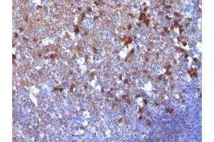 Formalin-fixed, paraffin-embedded human tonsil stained with IgG antibody (IG217) (小鼠 anti-人 IgG Antibody)