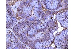 IHC analysis of RRP1 using anti-RRP1 antibody (ABIN7600683). (RRP1 抗体  (AA 22-237))