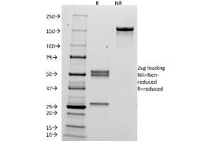 SDS-PAGE Analysis Purified hCG alpha Mouse Monoclonal Antibody (HCGa/53). (CGA 抗体)