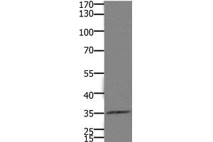 Western Blot analysis of Mouse kidney tissue using HOXD11 Polyclonal Antibody at dilution of 1:1100 (HOXD11 抗体)