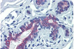 Breast, Human: Formalin-Fixed, Paraffin-Embedded (FFPE) (LIMD1 抗体  (N-Term))
