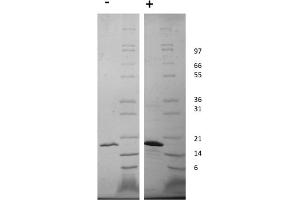 SDS-PAGE of Human Fibroblast Growth Factor-22 Recombinant Protein SDS-PAGE of Human Fibroblast Growth Factor-22 Recombinant Protein. (FGF22 蛋白)