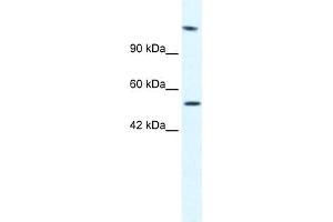 WB Suggested Anti-HELB Antibody Titration:  2. (DNA Helicase B 抗体  (N-Term))