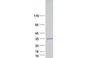 VCX2 Protein (Myc-DYKDDDDK Tag)