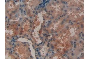 Detection of MMP12 in Human Kidney Tissue using Polyclonal Antibody to Matrix Metalloproteinase 12 (MMP12) (MMP12 抗体  (AA 290-469))