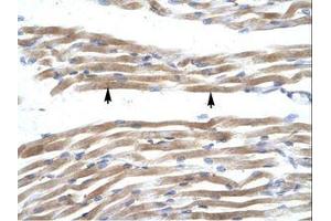 Image no. 1 for anti-Fatty Acid Binding Protein 3, Muscle and Heart (FABP3) (AA 46-95) antibody (ABIN202026) (FABP3 抗体  (AA 46-95))