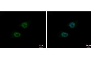 ICC/IF Image BLM antibody [N1N2], N-term detects BLM protein at nucleus by immunofluorescent analysis. (BLM 抗体  (N-Term))