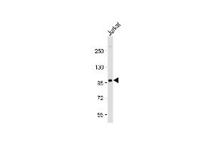 Anti-PI3KR1 Antibody (N-term L11) at 1:2000 dilution + Jurkat whole cell lysate Lysates/proteins at 20 μg per lane. (PIK3R1 抗体  (N-Term))