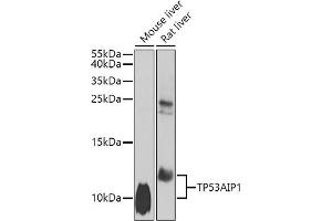 Western blot analysis of extracts of various cell lines, using TP53 antibody (ABIN6130605, ABIN6149411, ABIN6149413 and ABIN6223058) at 1:1000 dilution. (TP53AIP1 抗体  (AA 1-108))