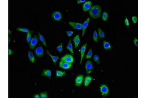 Immunofluorescent analysis of PC-3 cells using ABIN7169873 at dilution of 1:100 and Alexa Fluor 488-congugated AffiniPure Goat Anti-Rabbit IgG(H+L) (SNRPD1 抗体  (AA 1-119))