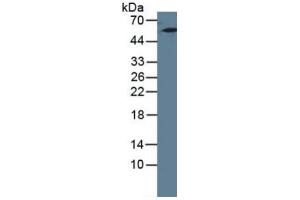 Western Blotting (WB) image for Keratin 7 (KRT7) ELISA Kit (ABIN6720512)