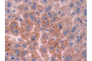 IHC-P analysis of Mouse Liver Tissue, with DAB staining. (UCP2 抗体  (AA 150-304))