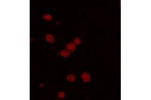 Immunofluorescence staining of PDE2A expressing cell with PDE2A polyclonal antibody . (PDE2A 抗体  (C-Term))