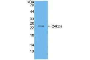 Detection of Recombinant BMF, Human using Polyclonal Antibody to Bcl2 Modifying Factor (BMF) (BMF 抗体  (AA 1-181))