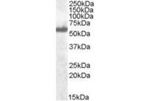 Image no. 1 for anti-Interferon Regulatory Factor 5 (IRF5) (C-Term) antibody (ABIN374255) (IRF5 抗体  (C-Term))