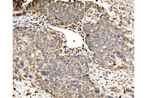 IHC analysis of LACTB using anti-LACTB antibody (ABIN7600047).