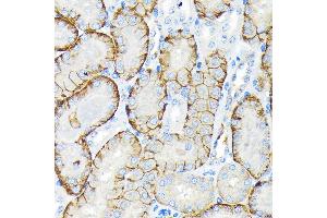 Immunohistochemistry of paraffin-embedded mouse kidney using SLC22/OCT3 Rabbit mAb (ABIN7269107) at dilution of 1:100 (40x lens). (SLC22A3 抗体)