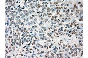 Image no. 2 for anti-Checkpoint Kinase 2 (CHEK2) antibody (ABIN1497498) (CHEK2 抗体)