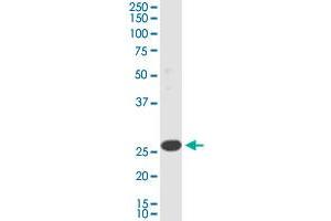 TMEM179B monoclonal antibody (M01), clone 3G8. (TMEM179B 抗体  (AA 1-219))