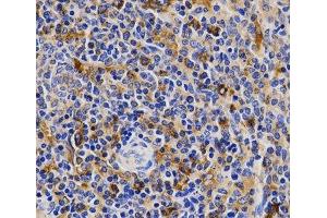 Immunohistochemistry of paraffin-embedded Rat spleen using CDK20 Polyclonal Antibody at dilution of 1:200 (40x lens). (CCRK 抗体)