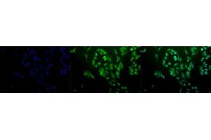 Immunocytochemistry/Immunofluorescence analysis using Rabbit Anti-Ubiquitin Polyclonal Antibody (ABIN361830 and ABIN361831). (Ubiquitin 抗体)