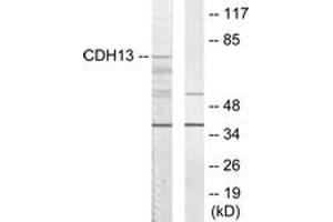 Western blot analysis of extracts from LOVO cells, using CDH13 Antibody. (Cadherin 13 抗体  (AA 331-380))